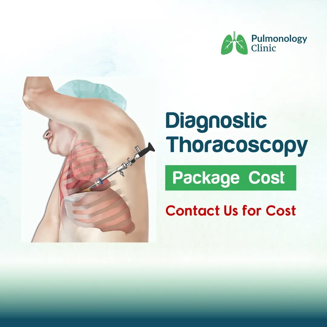 Diagnostic Thoracoscopy Diagnostic Thoracoscopy