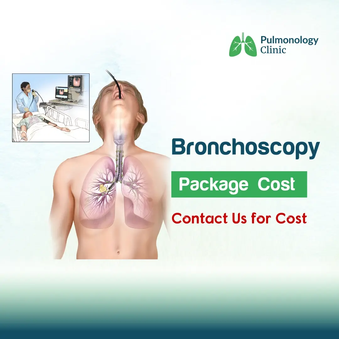 Bronchoscopy Bronchoscopy