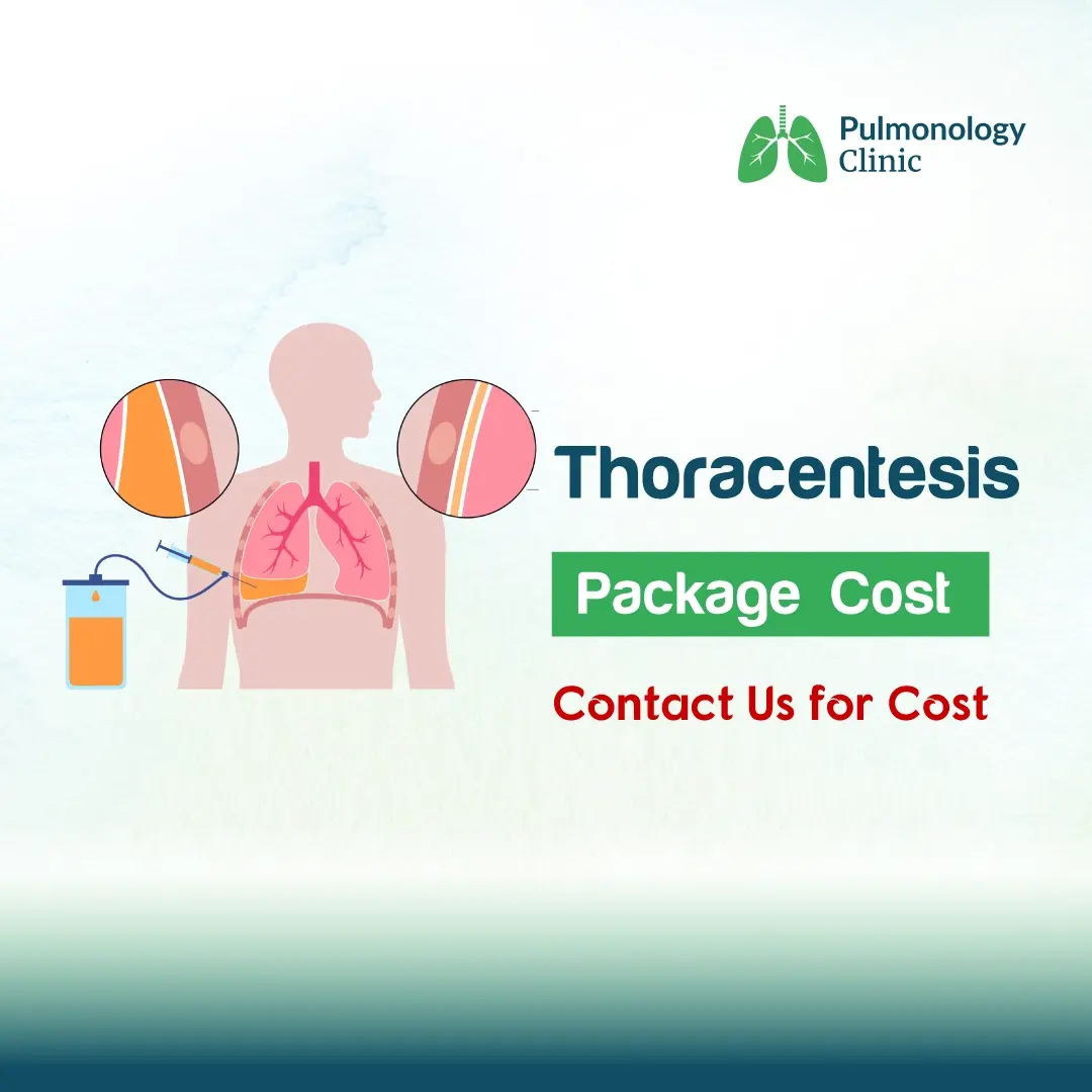 Thoracentesis Thoracentesis