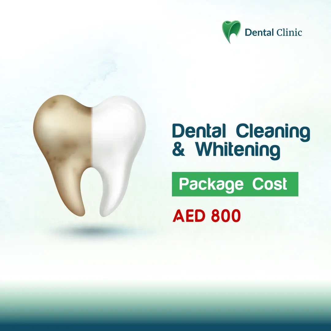 Dental Cleaning and Whitening Dental Cleaning and Whitening
