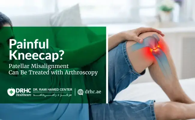 Painful Kneecap? Patellar Misalignment Can Be Treated with Arthroscopy