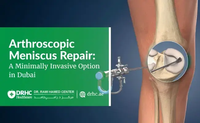 Arthroscopic Meniscus Repair: A Minimally Invasive Option in Dubai