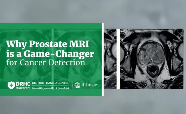 Why Prostate MRI is a Game-Changer for Cancer Detection