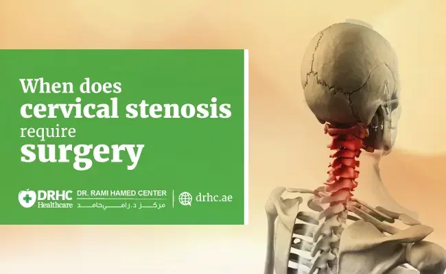 When does cervical stenosis require surgery