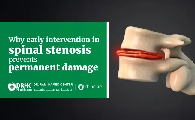 Why early intervention in spinal stenosis prevents permanent damage