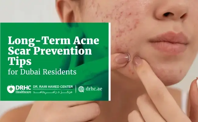 Long-Term Acne Scar Prevention Tips for Dubai Residents