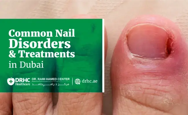 Common Nail Disorders & Treatments in Dubai
