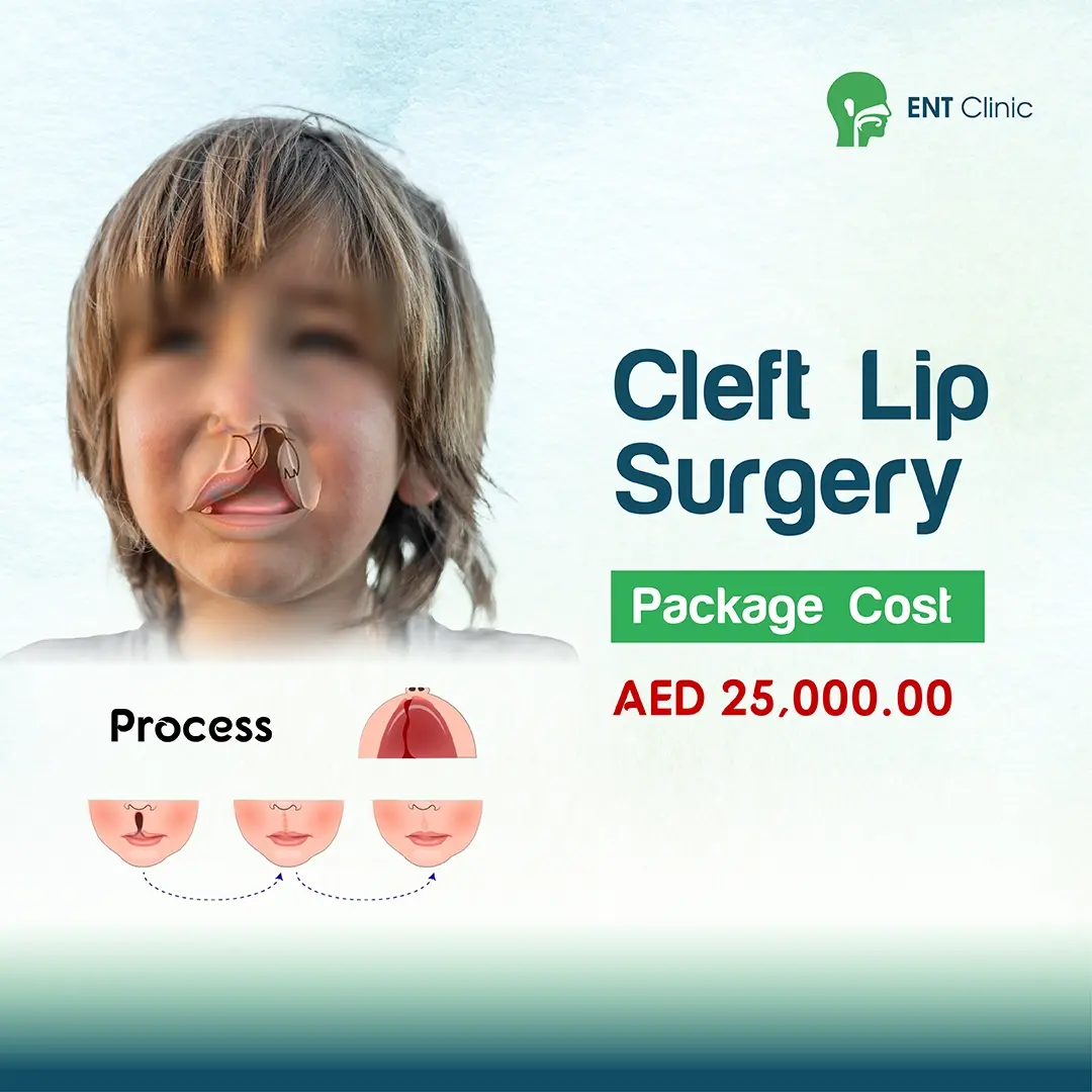 Cleft Lip Surgery Cleft Lip Surgery