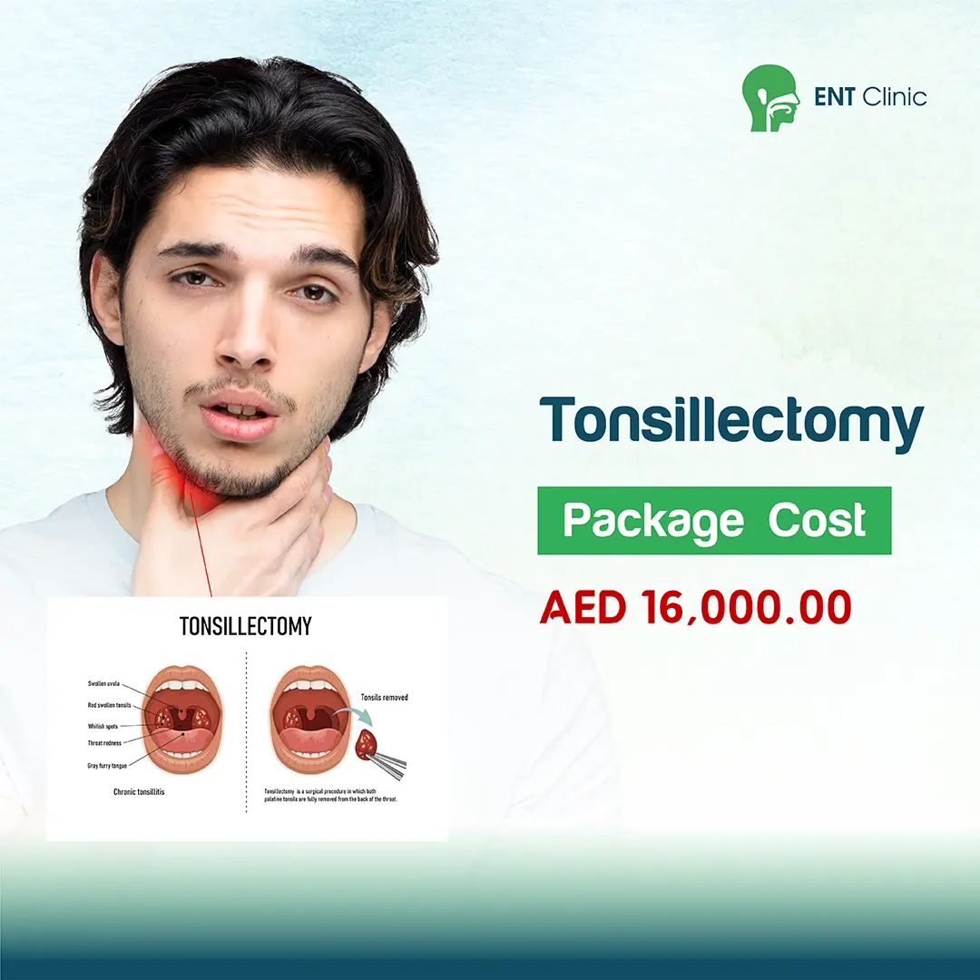 Tonsillectomy Package Tonsillectomy Package