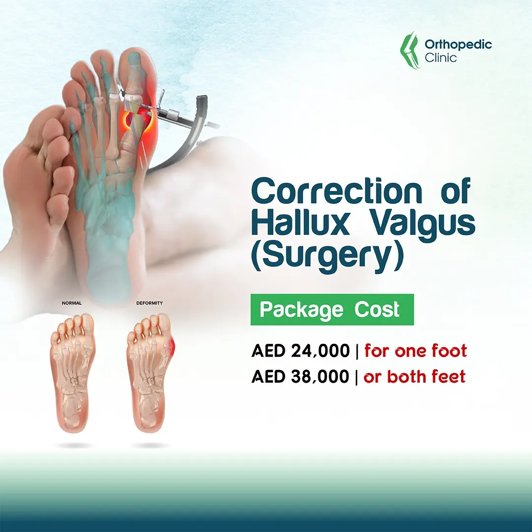 Correction of Hallux Valgus - Surgery Correction of Hallux Valgus - Surgery