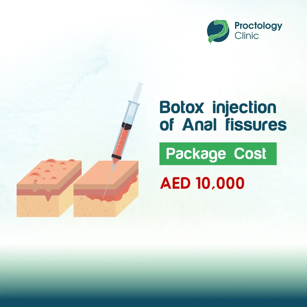 Botox injection of Anal fissures Botox injection of Anal fissures