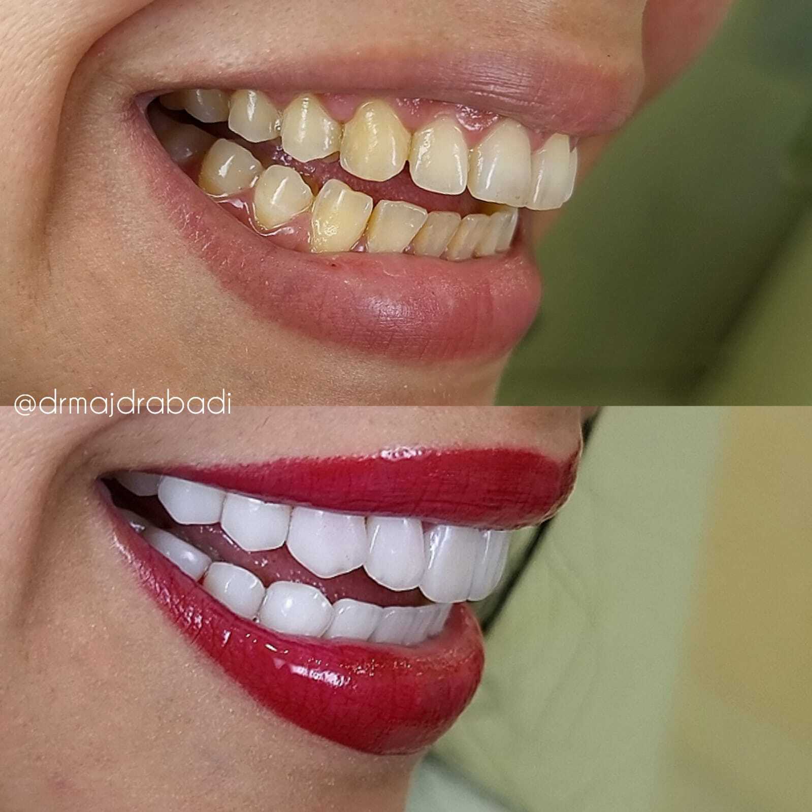 Dental