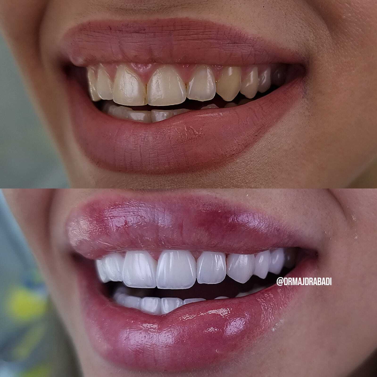 Dental