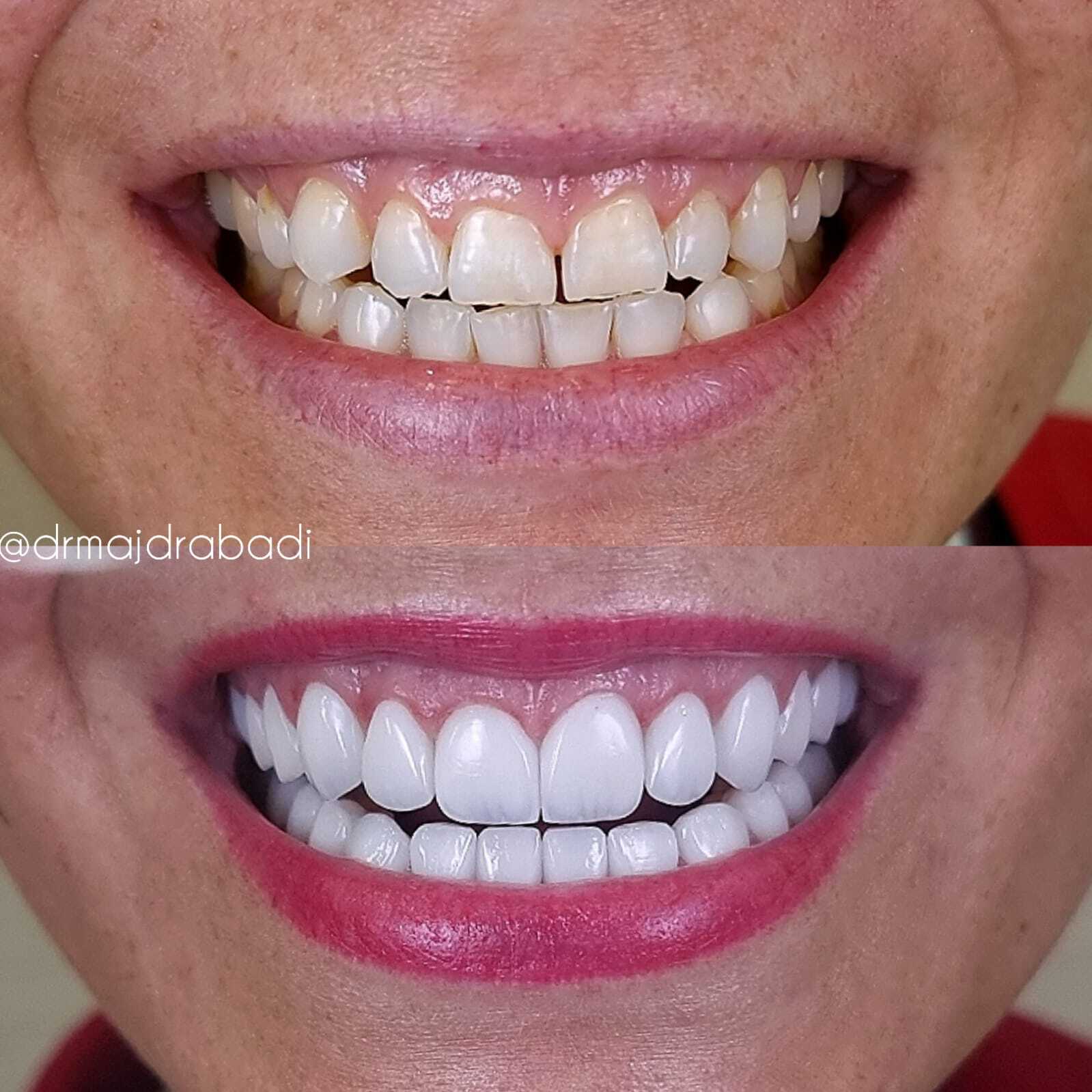 Dental