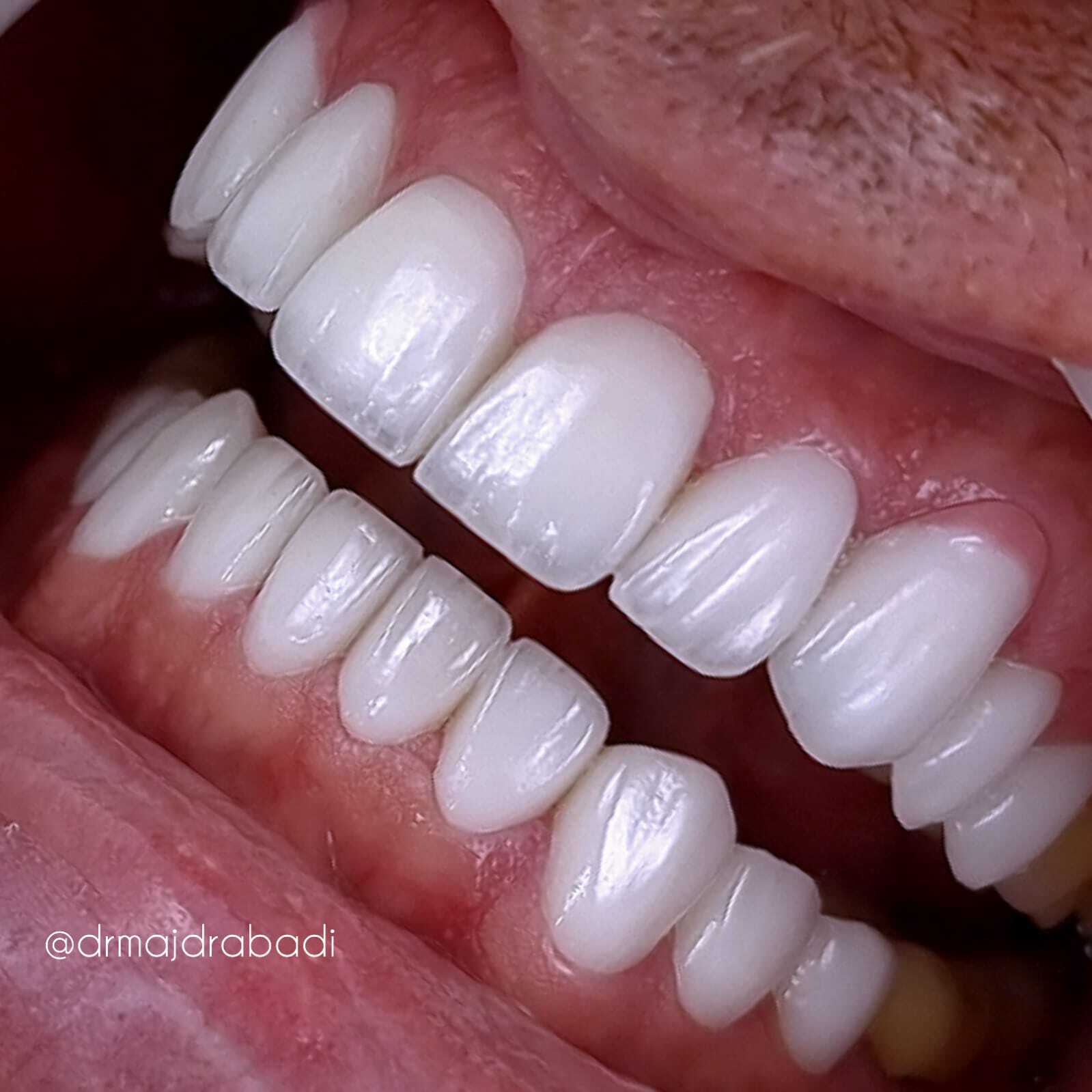 Dental
