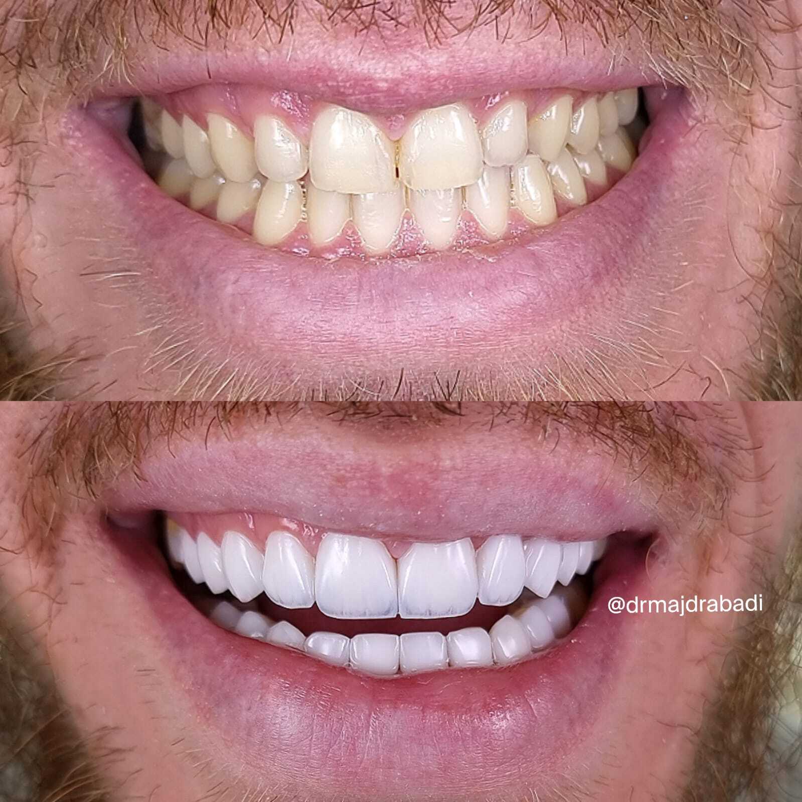 Dental