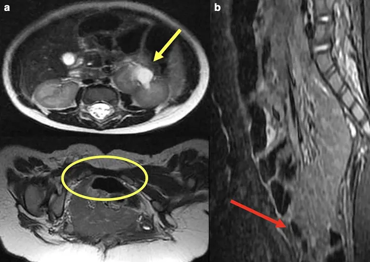 Dynamic Abdomen MRI Dubai