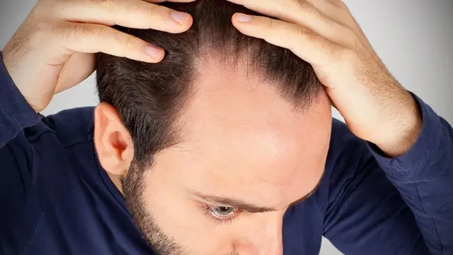Early Hair Thinning? 7 Signs You Should Start Treatment Before It’s Too Late