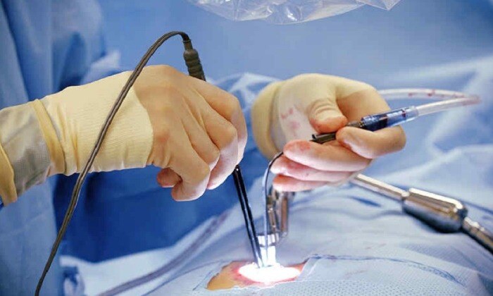 How risky is endoscopic discectomy?