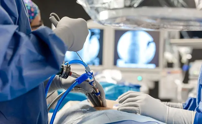 Endoscopic Spine Surgery: The Key to Minimal Pain and Maximum Speed of Recovery