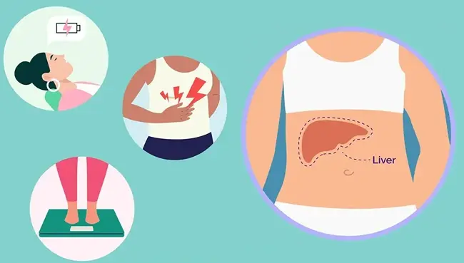 Fatty Liver Without Symptoms: Why It Is Often Found by Accident