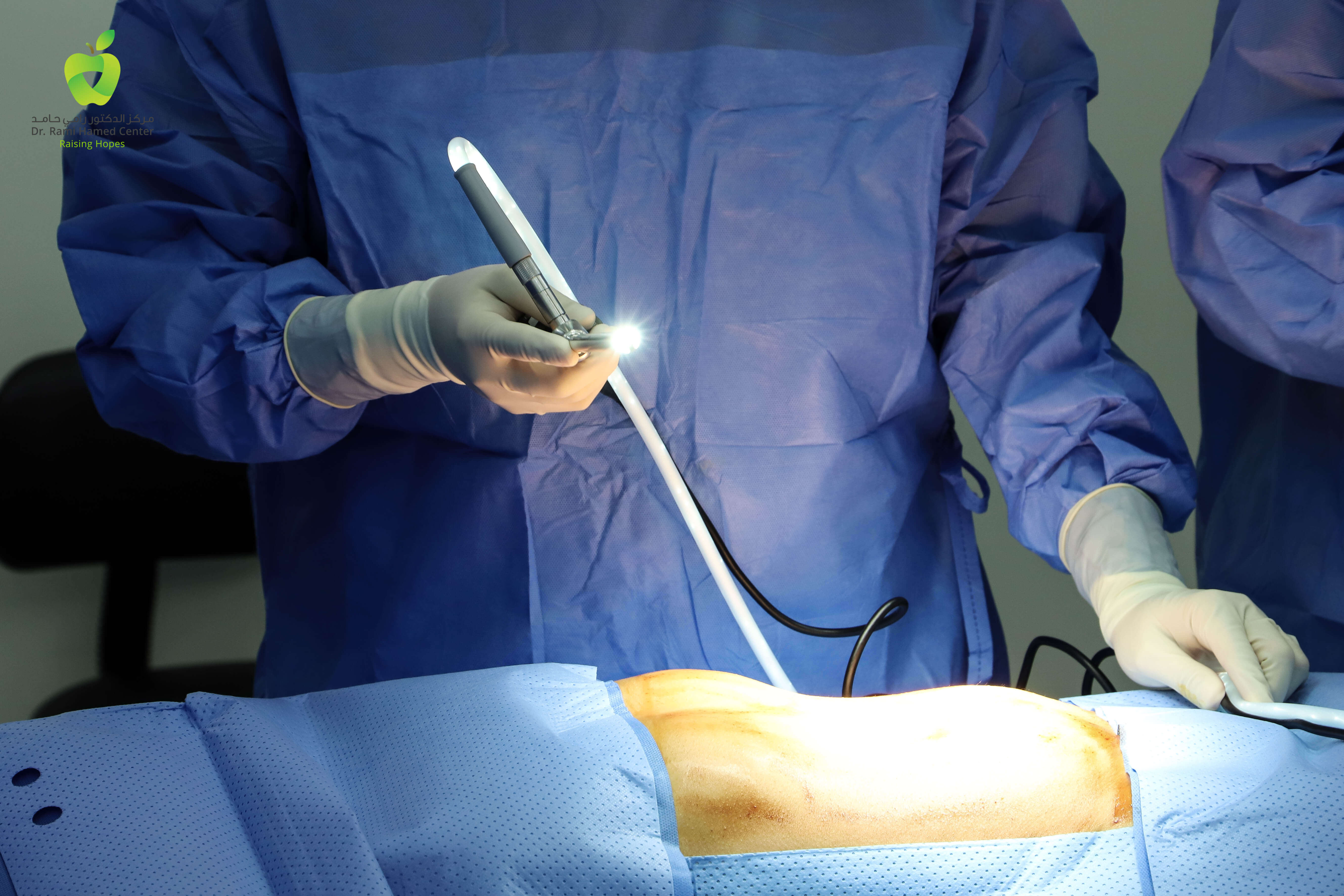 Laparoscopic Cholecystectomy - Dubai General Surgery Clinic