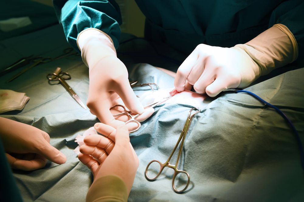 General Surgery