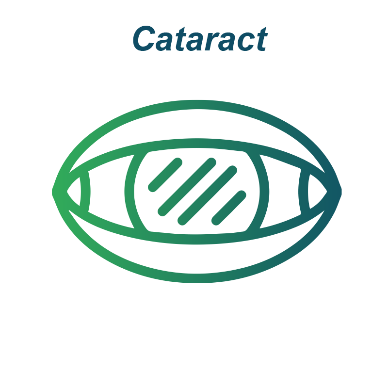 Cataract