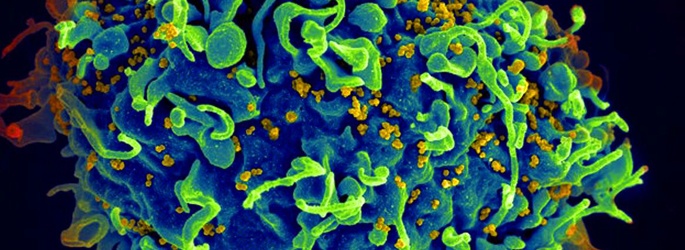 Hiv Test Aids Test Dubai Drhc Hiv Test Aids Test Dubai Drhc