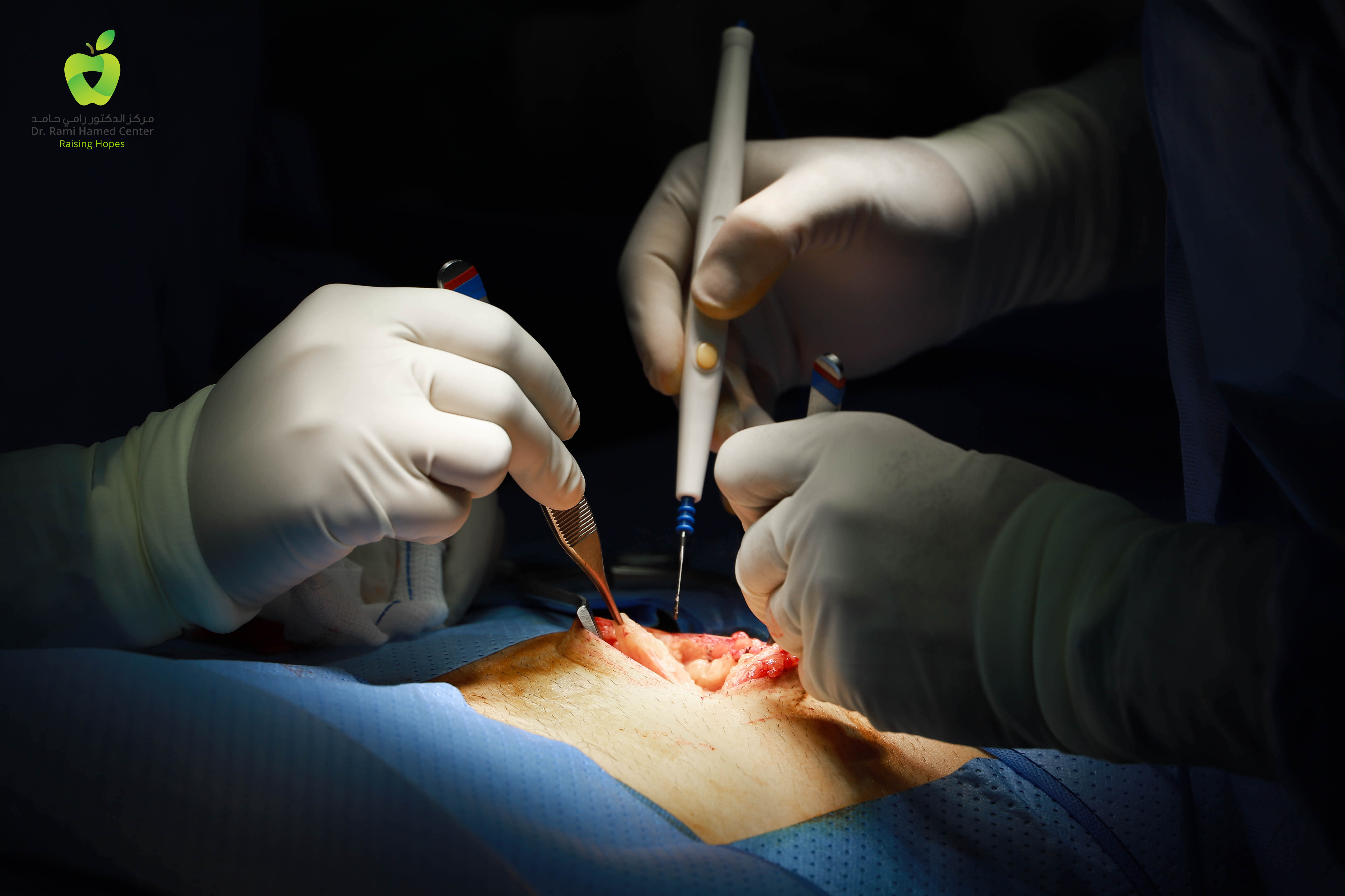 Dubai Hernia Surgery Clinic