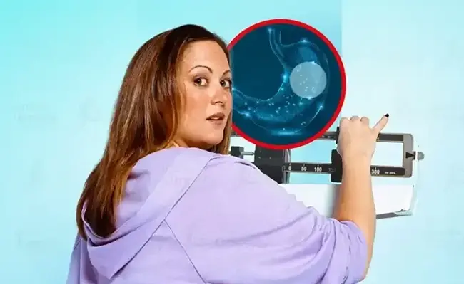 How Much Weight Could You Lose With a Gastric Balloon?