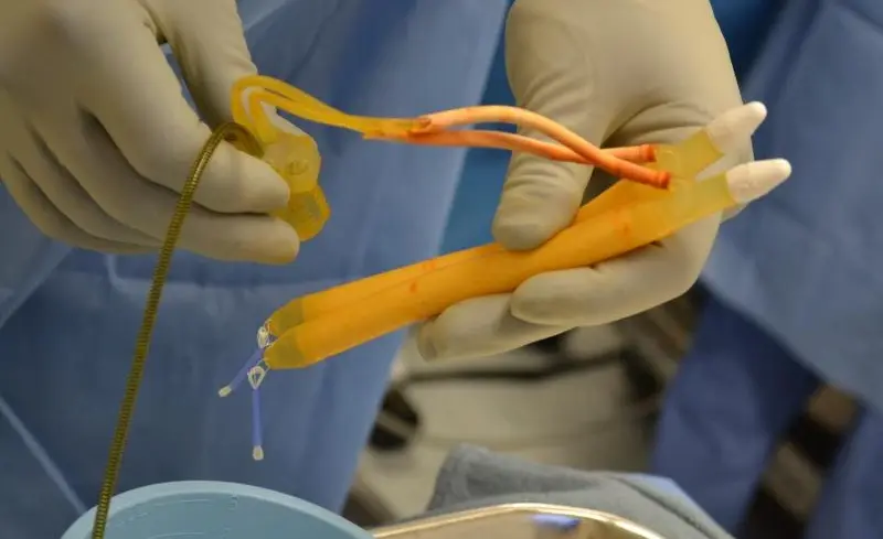 Infected Penile Implant Removal & Salvage Surgery