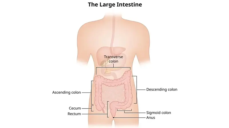 Large Intestine and Rectum Surgery