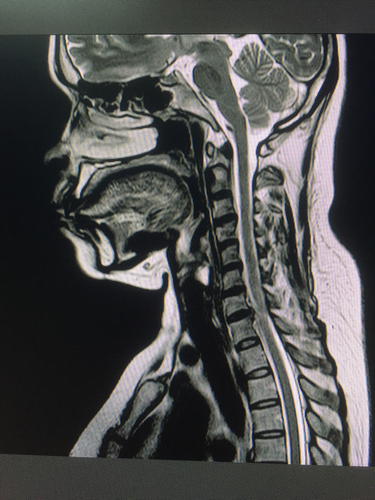 Possible Complications