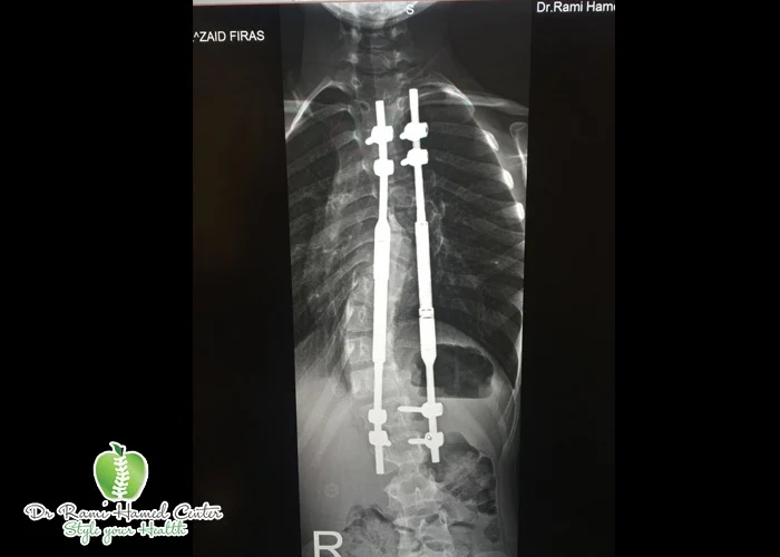 Orthopedic-8