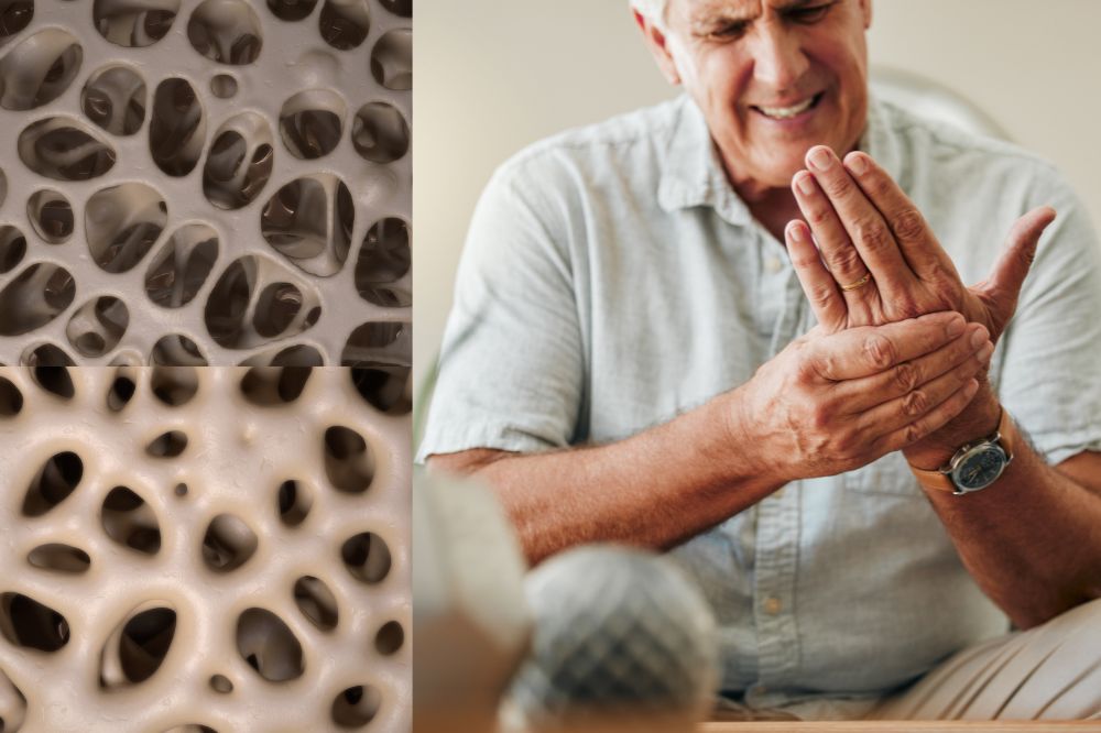 Osteoporosis treatment dubai