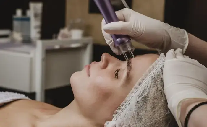 PRP for Skin Rejuvenation treatment Dubai