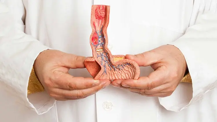 Penile Cancer Diagnosis & Treatment