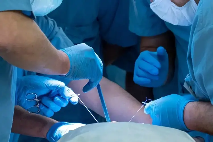 Penile Reconstruction After Cancer Surgery Penile Reconstruction After Cancer Surgery