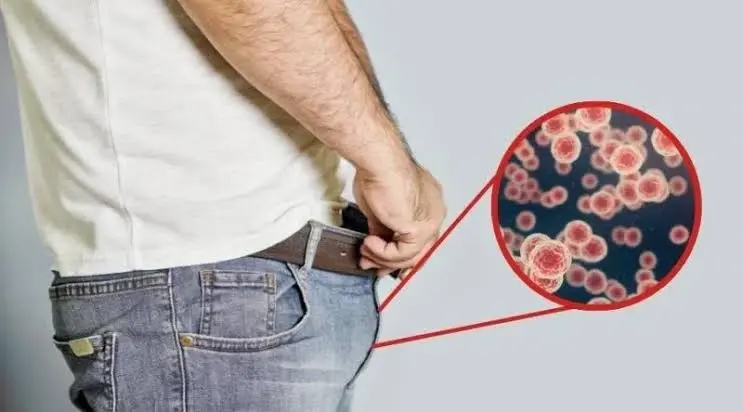 Penile Skin, Lesions, Warts & Cancer