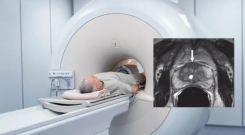 Prostate MRI Dubai