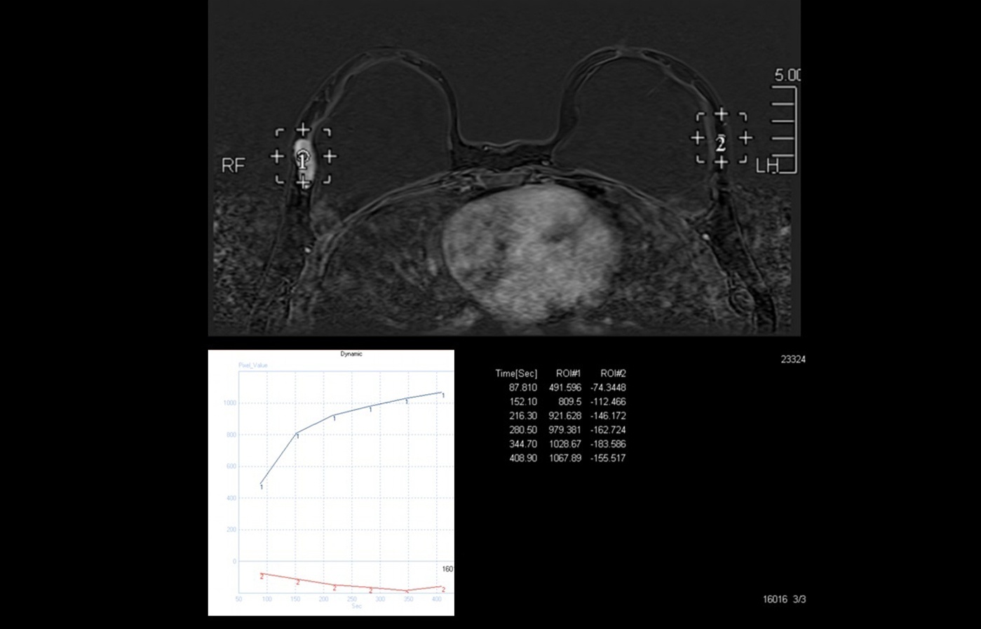 Mri slide dynamic