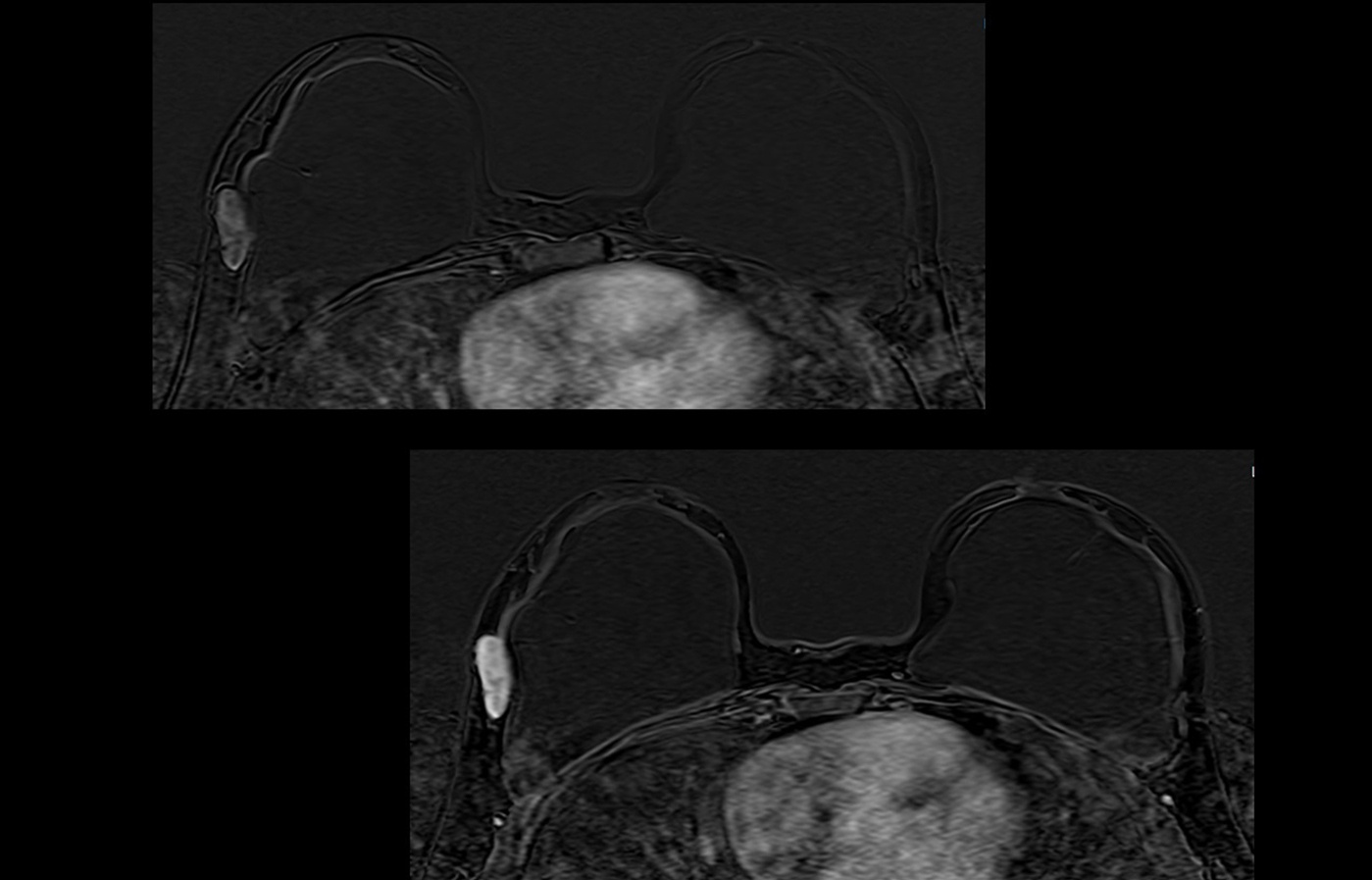 mri slide dynamic