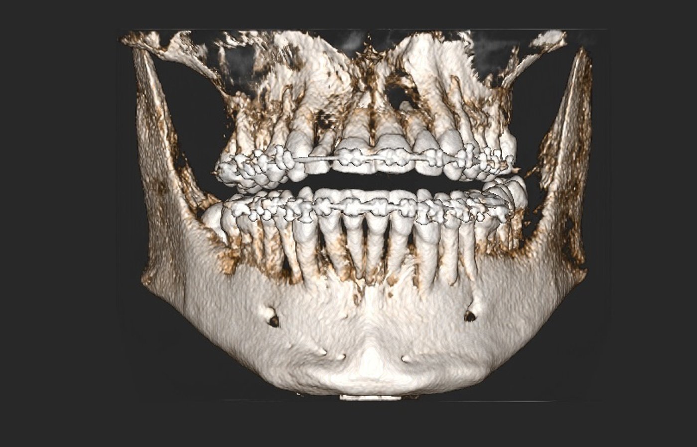 cbct 3d