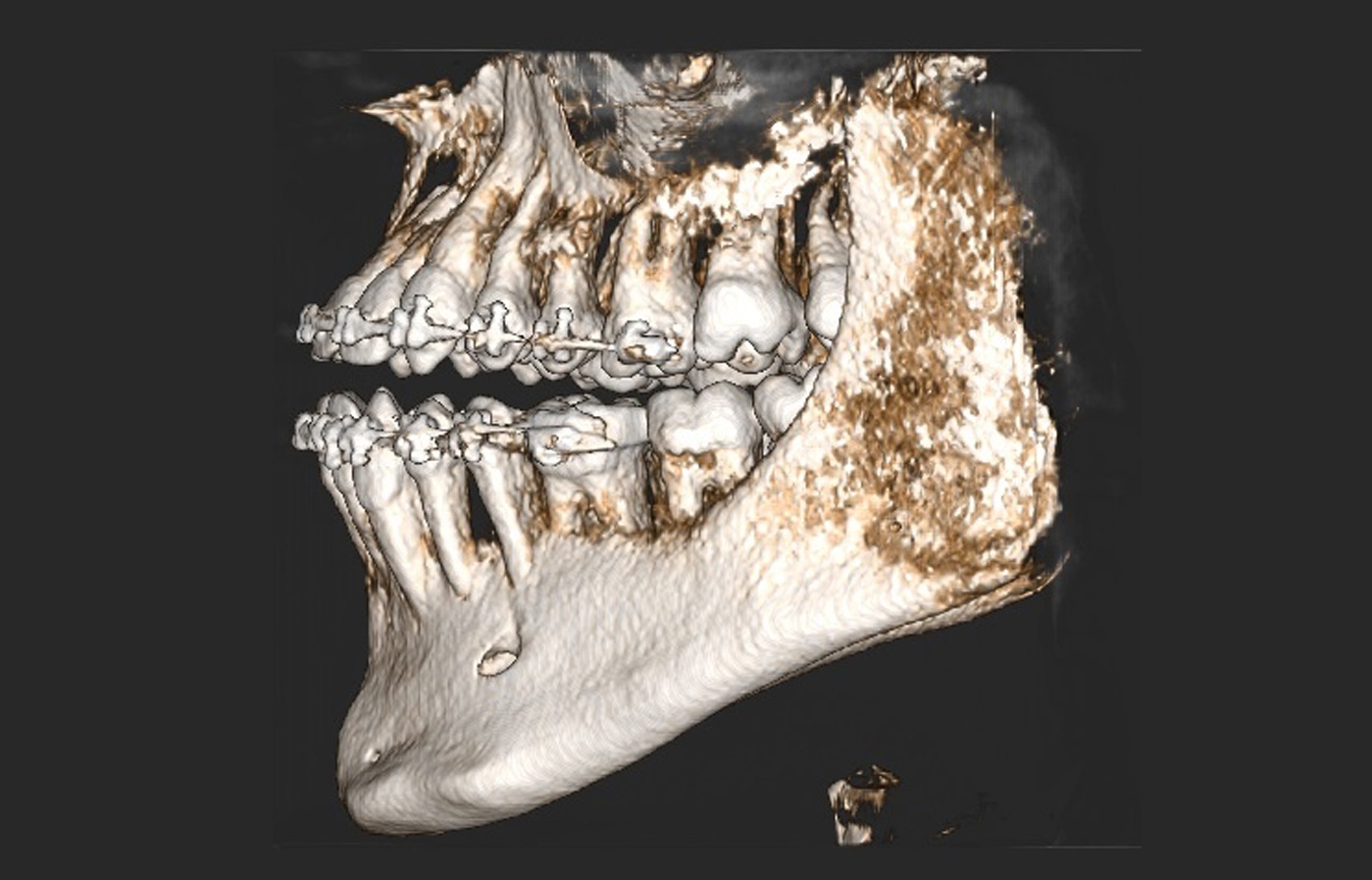 cbct 3d