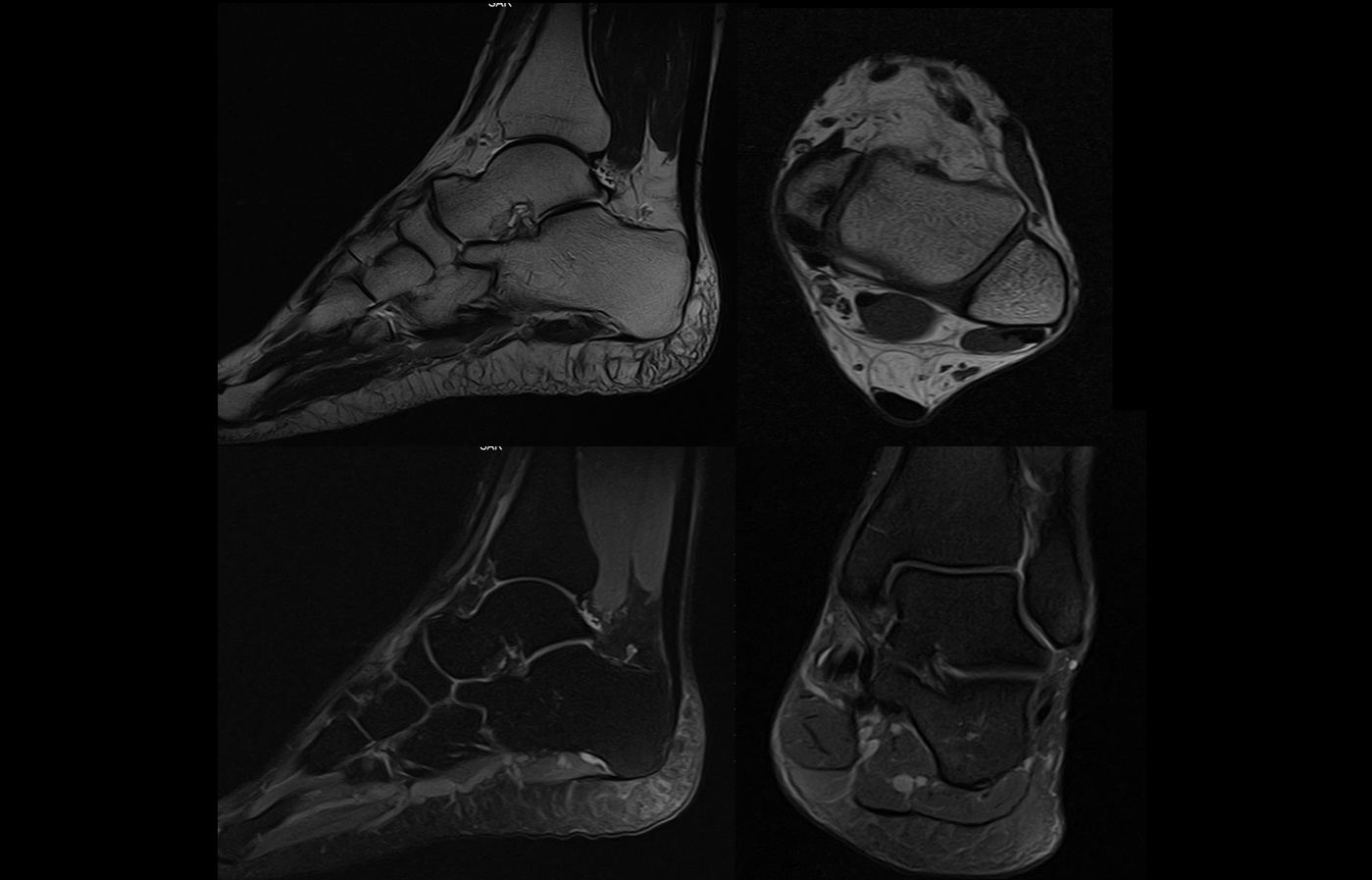 mri_ankle_slide-01.jpg