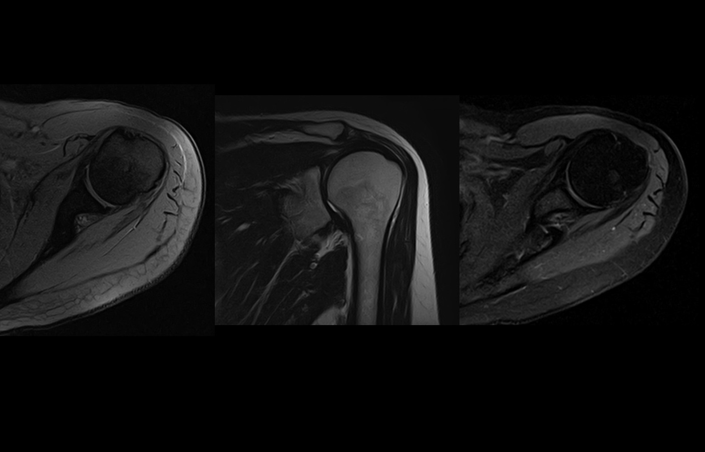 mri_shoulder_slide0.jpg