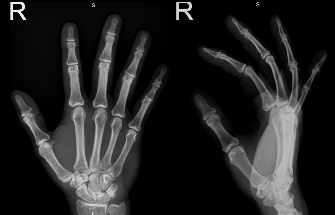 Xr_slide_hand0.jpg