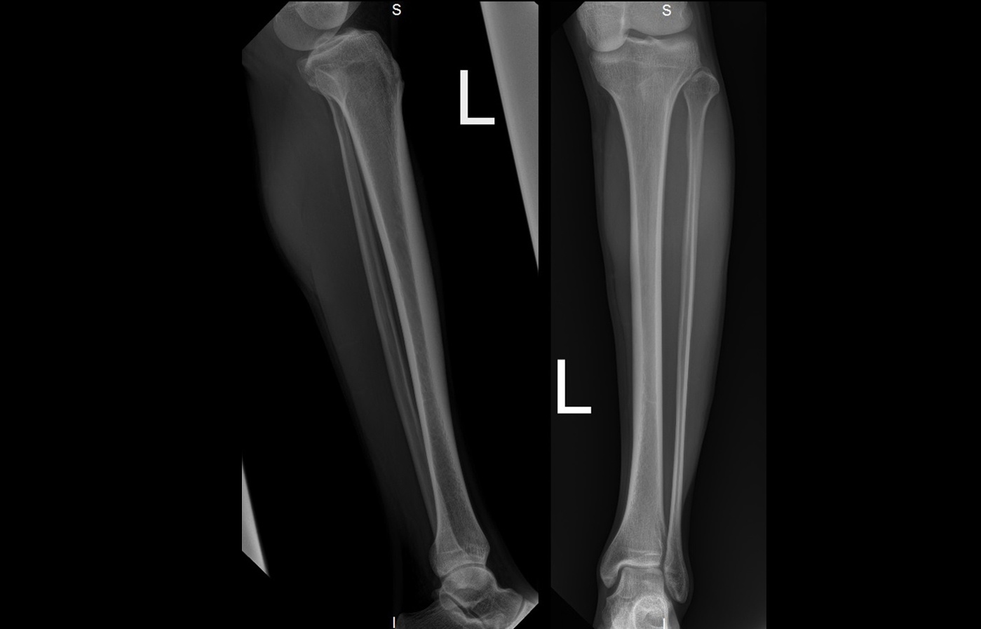 Xr_slide_leg0.jpg