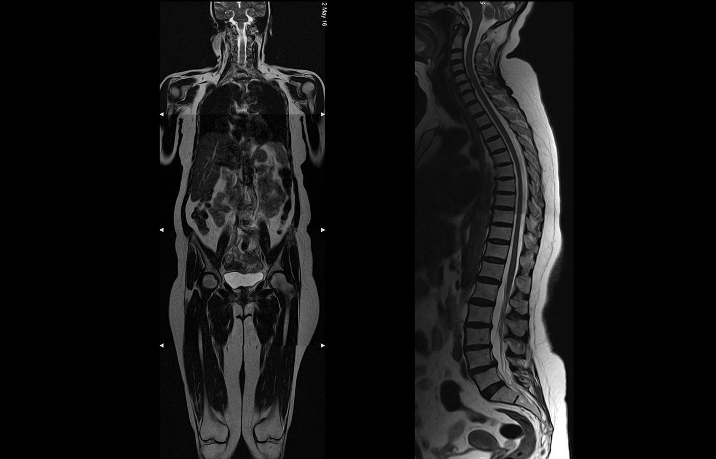 mri stitching slide